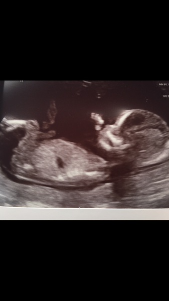 Boy or girl?!