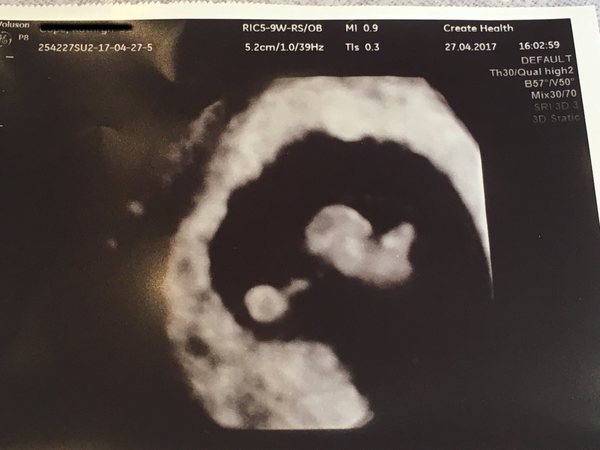 December 2017 #3 - Beware! There is much talk about food on this thread!