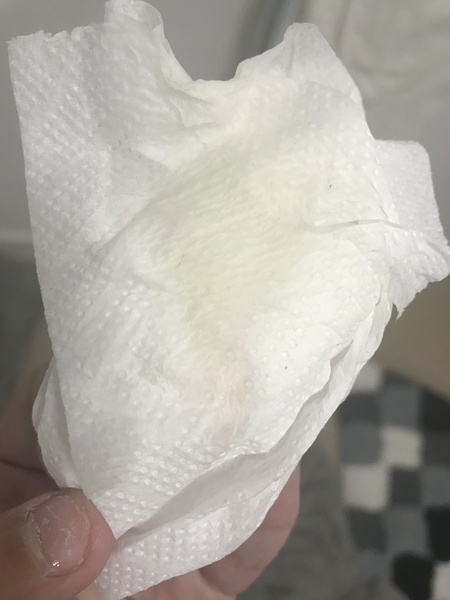 Implantation bleeding? Picture included.