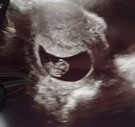 Early Scans: What did you see? (8+4)