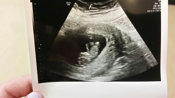 All November Babies Welcome, bring on the 12 week scans