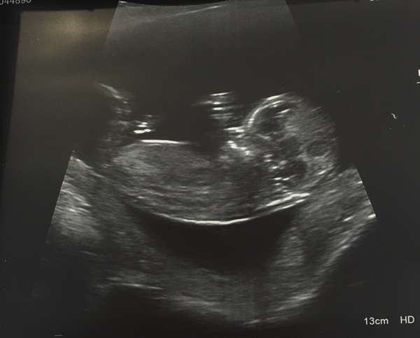 Gender Guesses!