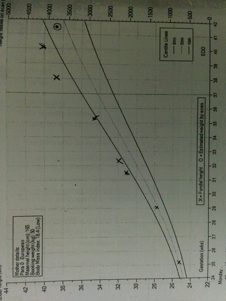 May 2017 #11 Not long to go until the first baby shows!