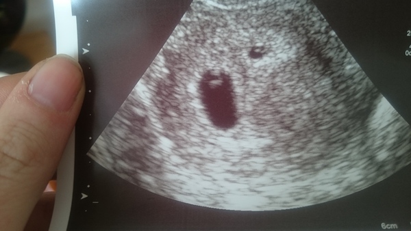 How many weeks is this scan?