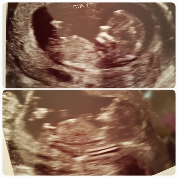 First Time Pregnancy