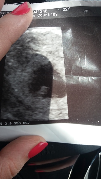 Early Scans: What did you see? (8+4)