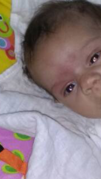 To think my baby has eye cancer