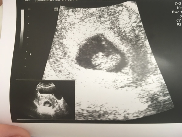 gender guess?