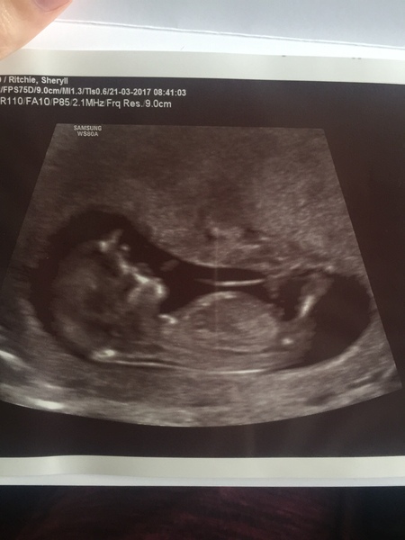 Gender prediction????? Next week but need thoughts