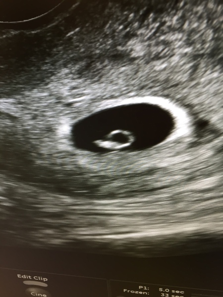 December 2017 babies