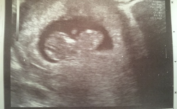 Getting Ready For Baby Challenge - Thread 8