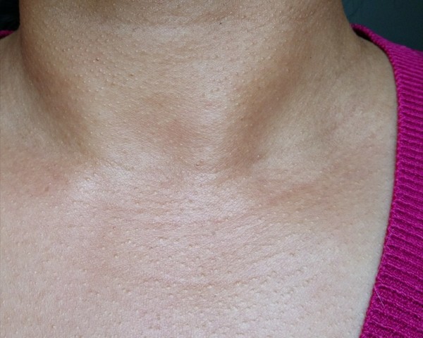 Those Crisscross Things On My Neck?