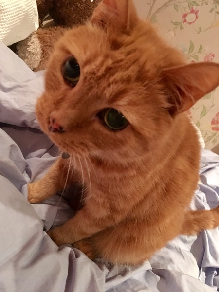 Malfoy has pancreatitis and high calcium