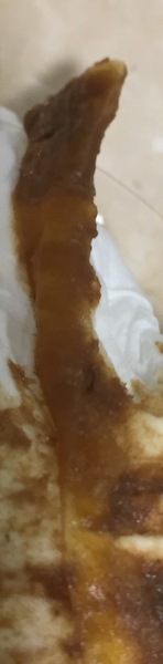 Does my son have worms? (TMI as there's a pic!)