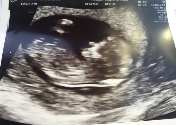 Getting Ready For Baby Challenge - Thread 7