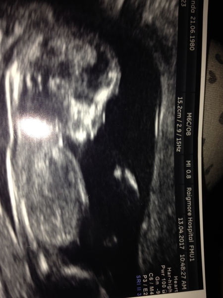 gender guess?