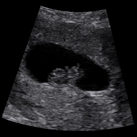 December 2017 #3 - Beware! There is much talk about food on this thread!