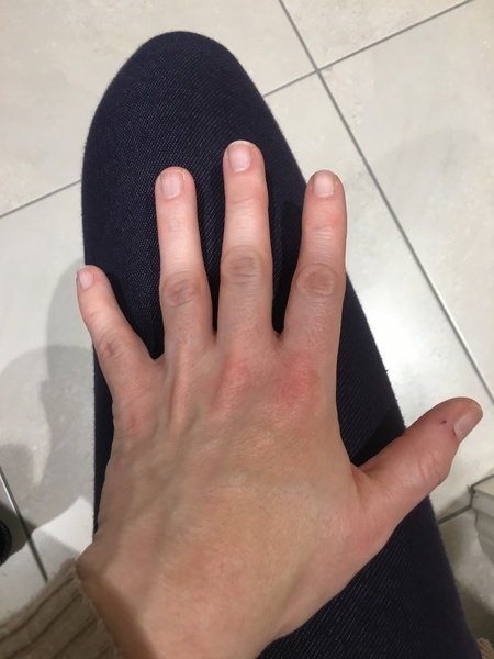 Weird symptoms - please help diagnose me