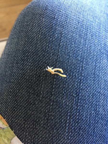 The Short Cervix Club