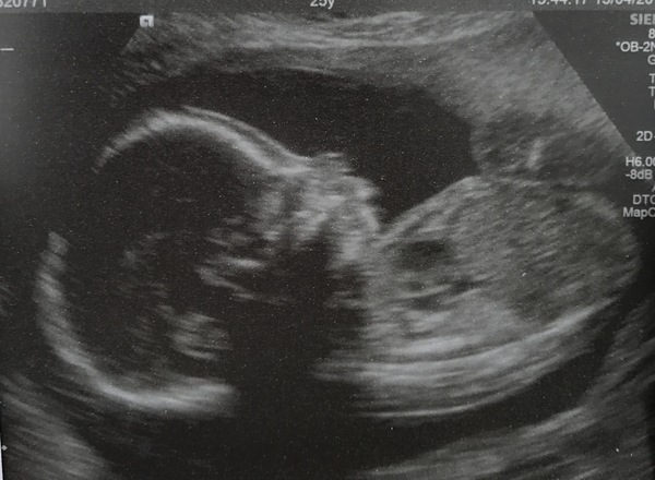 #TTC1 - Second Wave grads thread the Second!