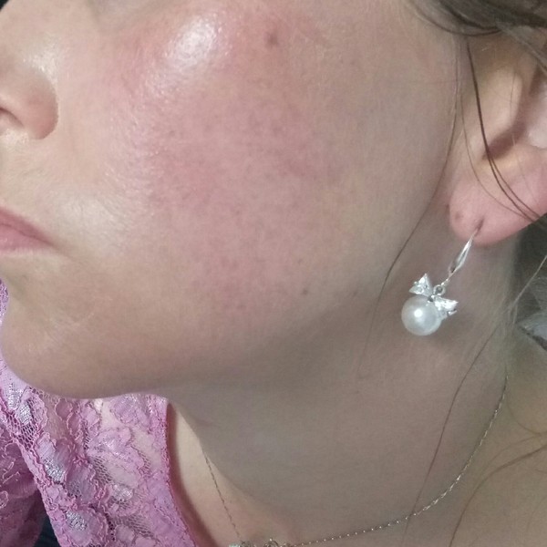 Help - my skin's reacting and I don't know what to do!?!