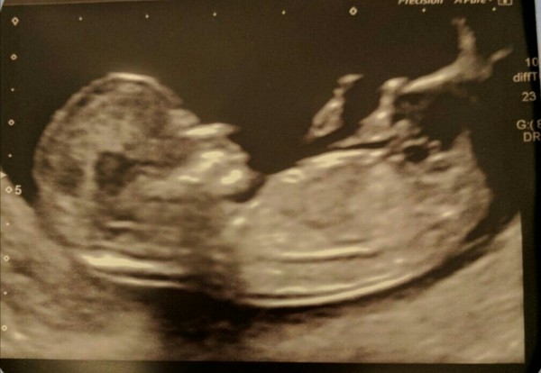 All November Babies Welcome, bring on the 12 week scans
