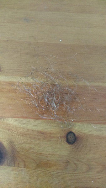 Hairloss whats normal (pic included)