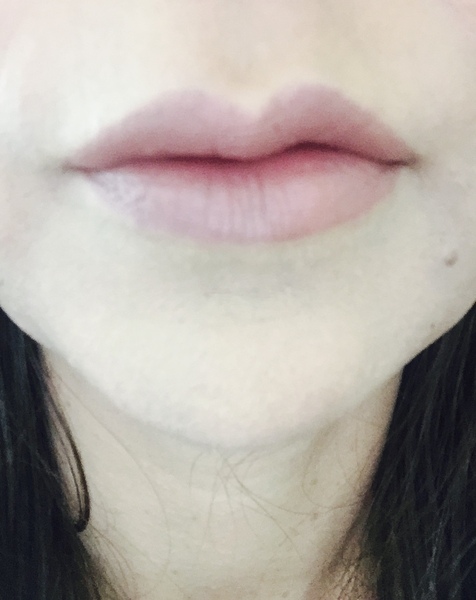 Face care at 50 to Botox or not to botox that is the question....