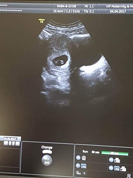 First Time Pregnancy