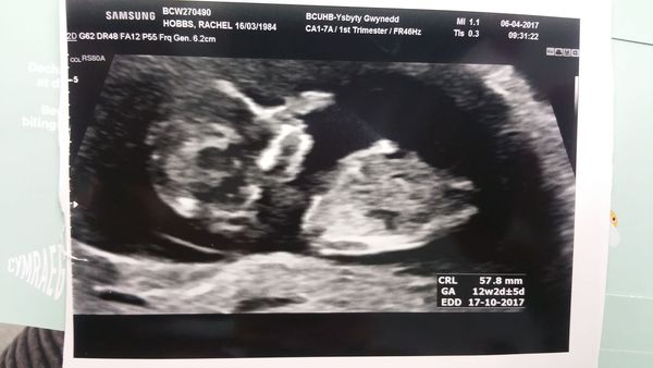 October Babies No. 3