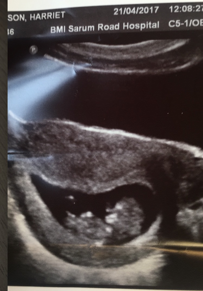 Biscuits, official scans & the end of the trimester - Later November due dates this way...