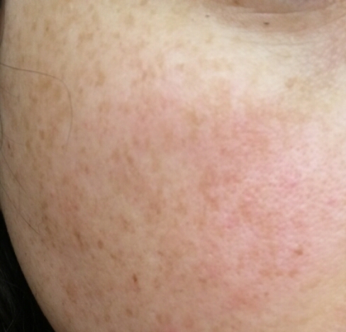 30 weeks have woken up with rosy cheeks