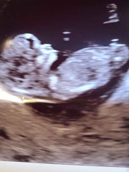 October Babies No. 3