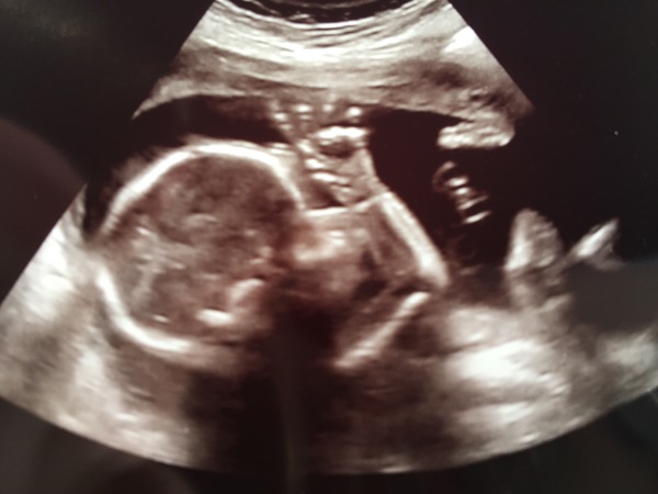 #TTC1 - Second Wave grads thread the Second!