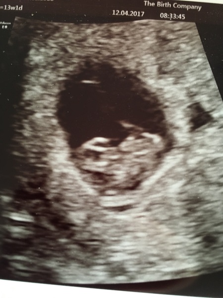 First Time Pregnancy
