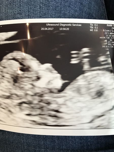 All November Babies Welcome, bring on the 12 week scans