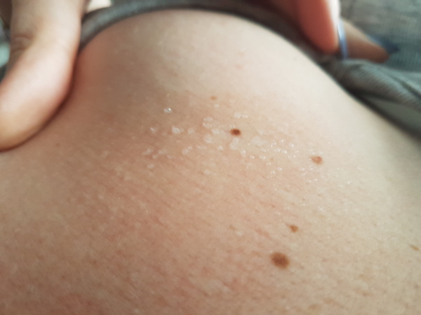 Usual virus symptoms or should I get a second opinion?