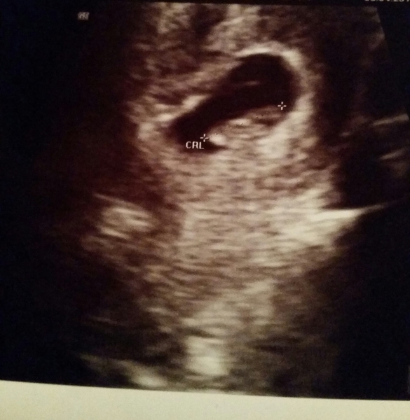 Staying posifrickentive- Thread 15 for ladies pg after mc