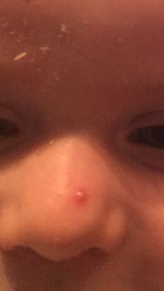 Where do we stand on the subject of dc spots..?