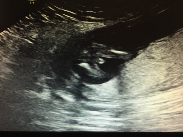 Ultrasound advice
