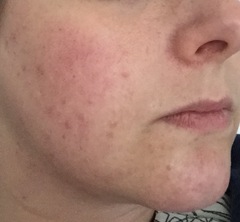 Fantastic Skincare -  we're snail here 🐌