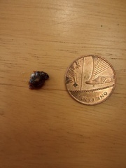 Ear wax extraction story. WITH PICTURES