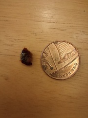 Ear wax extraction story. WITH PICTURES