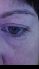 Has anyone used My Perfect Eyes