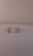 False bfp?