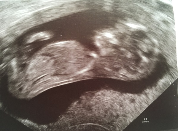 Getting Ready For Baby Challenge - Thread 8