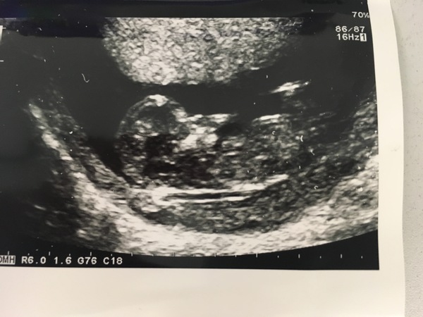 Gender guess??