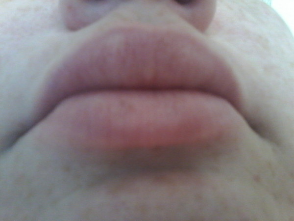Big lips