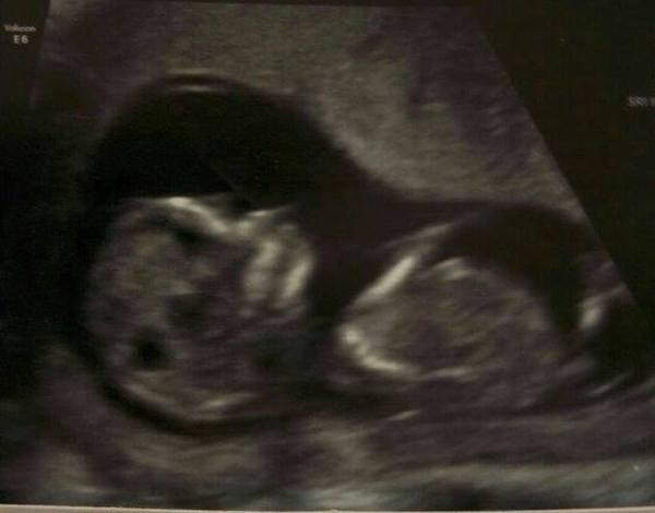 All November Babies Welcome, bring on the 12 week scans