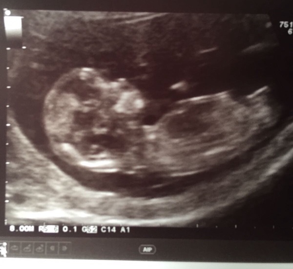 #TTC1 - Second Wave grads thread the Second!